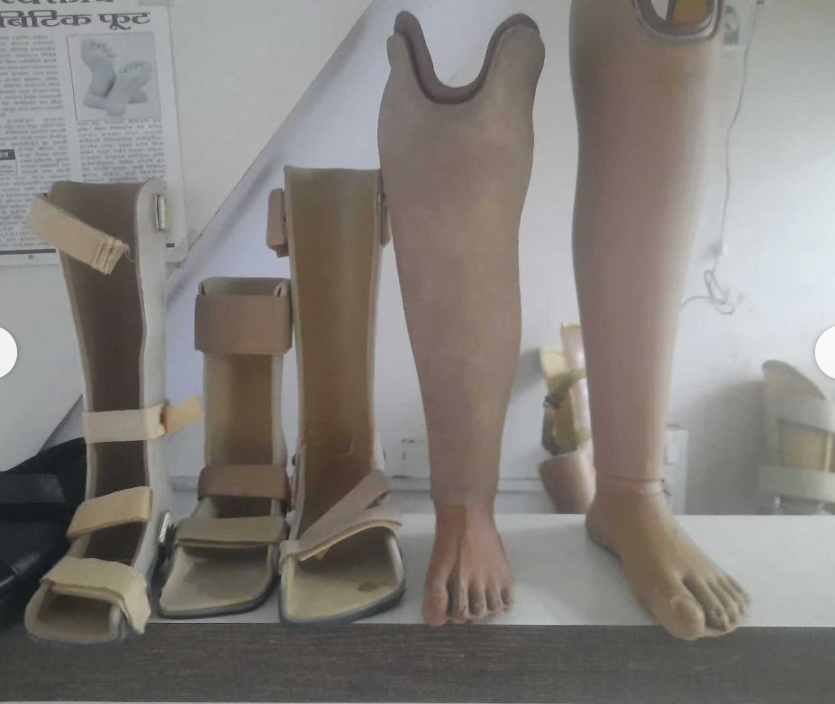 Ankle-foot orthoses and below-knee prostheses finished and standing on the workshop shelf at Sawant Meditronic Orthocraft